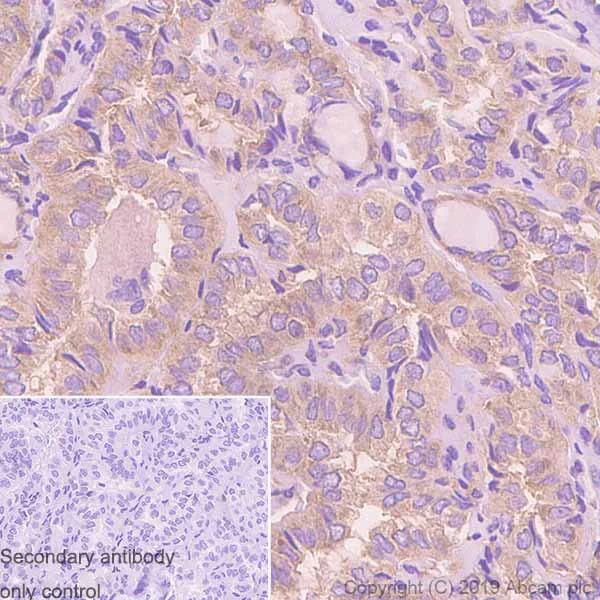 Immunohistochemistry (Formalin/PFA-fixed paraffin-embedded sections) - Anti-MetRS/MARS antibody [EPR9872] - BSA and Azide free (AB250200)