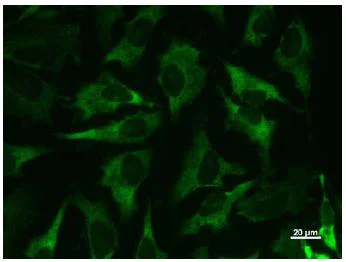 Immunocytochemistry/ Immunofluorescence - Anti-MetRS/MARS antibody [MARSD10B4] (AB50793)