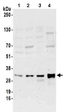 Western blot - Anti-METTL1 antibody (AB157097)
