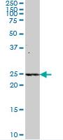 Western blot - Anti-METTL11A antibody (AB72660)