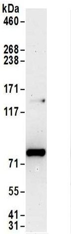 Immunoprecipitation - Anti-METTL13 antibody (AB186002), expandable thumbnail