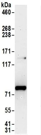 Immunoprecipitation - Anti-METTL13 antibody (AB186002)