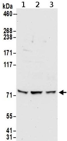 Western blot - Anti-METTL13 antibody (AB186002), expandable thumbnail