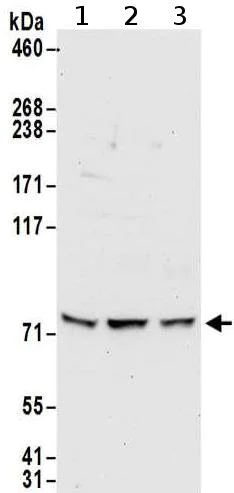 Western blot - Anti-METTL13 antibody (AB186002)