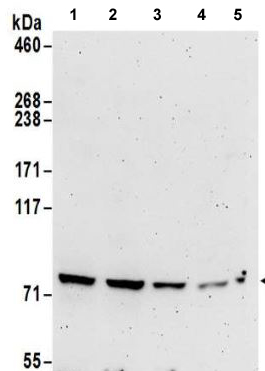 Western blot - Anti-METTL13 antibody - C-terminal (AB186008), expandable thumbnail