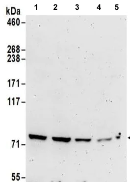 Western blot - Anti-METTL13 antibody - C-terminal (AB186008)