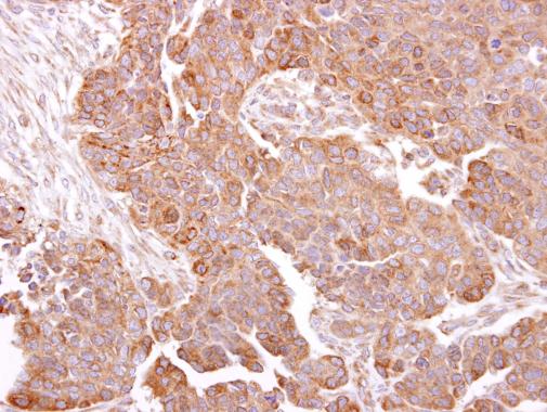 Immunohistochemistry (Formalin/PFA-fixed paraffin-embedded sections) - Anti-METTL13 antibody - N-terminal (AB229145)