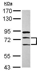 Western blot - Anti-METTL13 antibody - N-terminal (AB229145)
