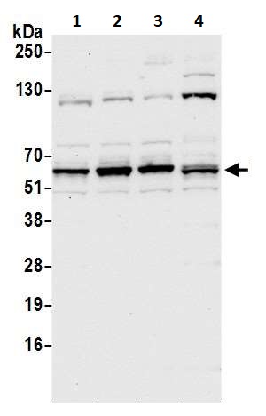 Western blot - Anti-METTL14 antibody (AB252562), expandable thumbnail