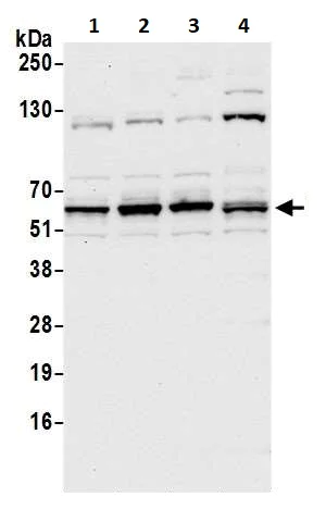 Western blot - Anti-METTL14 antibody (AB252562)