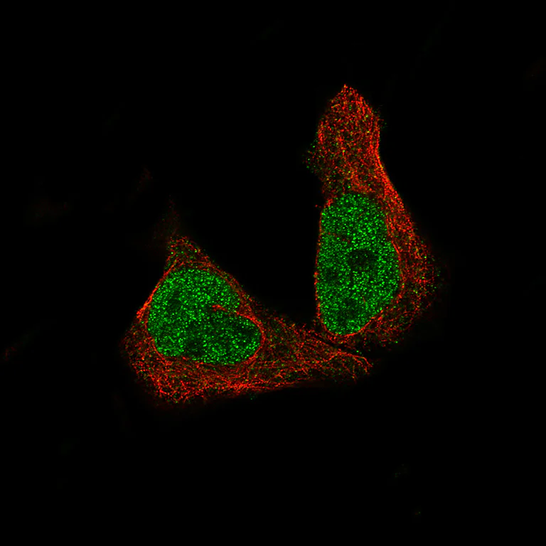 Immunocytochemistry/ Immunofluorescence - Anti-METTL14 antibody [CL4252] (AB220030)