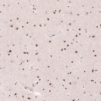 Anti-METTL14 antibody [CL4252] Mouse monoclonal (ab220030) | Abcam