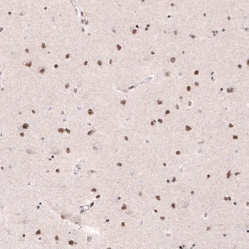 Immunohistochemistry (Formalin/PFA-fixed paraffin-embedded sections) - Anti-METTL14 antibody [CL4252] (AB220030)