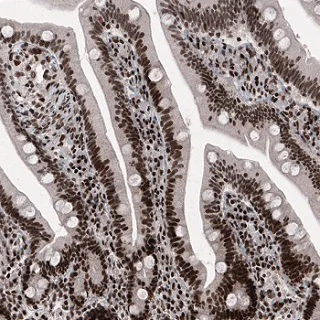 Immunohistochemistry (Formalin/PFA-fixed paraffin-embedded sections) - Anti-METTL14 antibody [CL4252] (AB220030)