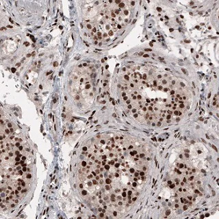 Immunohistochemistry (Formalin/PFA-fixed paraffin-embedded sections) - Anti-METTL14 antibody [CL4252] (AB220030)