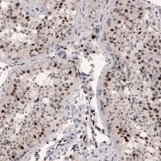 Immunohistochemistry (Formalin/PFA-fixed paraffin-embedded sections) - Anti-METTL14 antibody [CL4254] (AB220031)