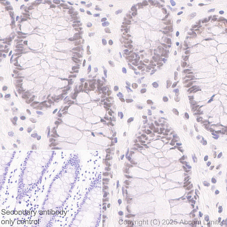 Immunohistochemistry (Formalin/PFA-fixed paraffin-embedded sections) - Anti-METTL14 antibody [EPR27233-258] (AB323866)
