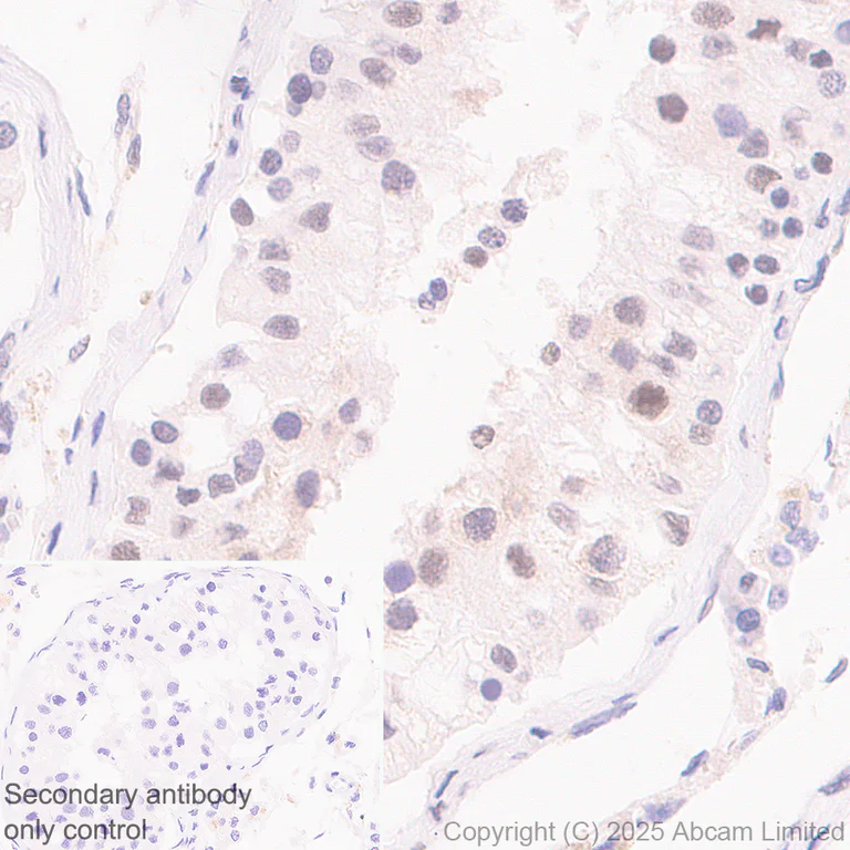 Immunohistochemistry (Formalin/PFA-fixed paraffin-embedded sections) - Anti-METTL14 antibody [EPR27233-258] (AB323866)