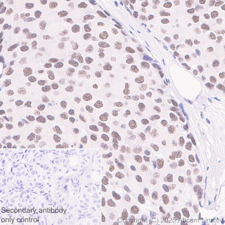 Immunohistochemistry (Formalin/PFA-fixed paraffin-embedded sections) - Anti-METTL14 antibody [EPR27233-258] (AB323866)