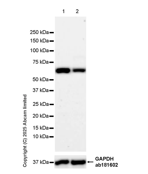 Western blot - Anti-METTL14 antibody [EPR27233-258] (AB323866)