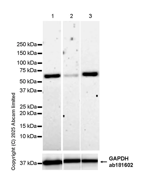 Western blot - Anti-METTL14 antibody [EPR27233-258] (AB323866)
