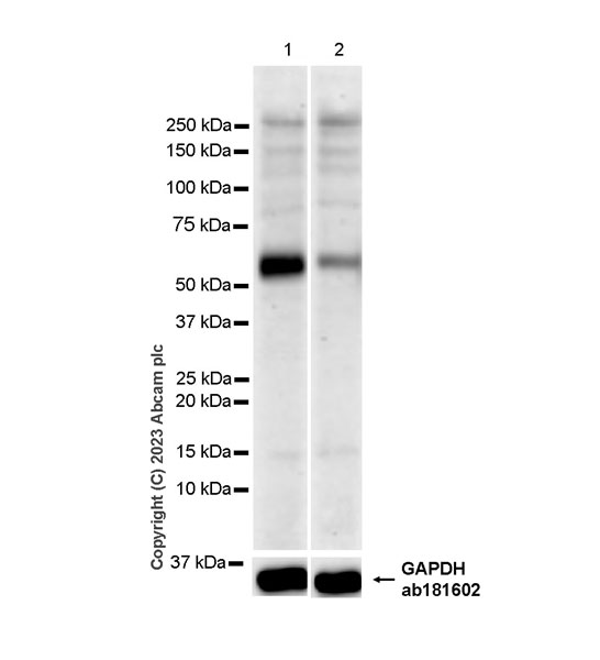 Western blot - Anti-METTL14 antibody [EPR27234-62] (AB309096), expandable thumbnail