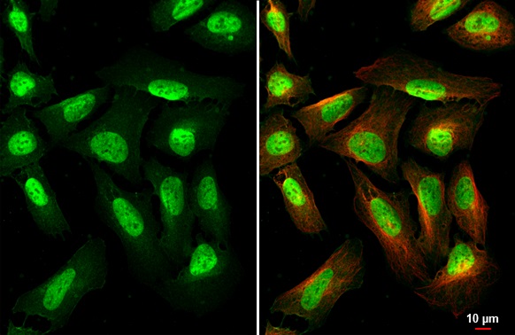 Immunocytochemistry/ Immunofluorescence - Anti-METTL14 antibody [HL1816] (AB308576)
