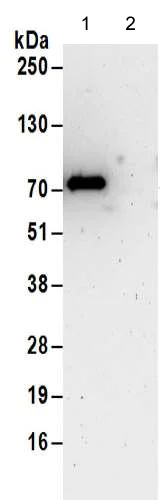 Immunoprecipitation - Anti-METTL16 antibody (AB185990)