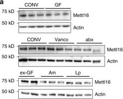 Western blot - Anti-METTL16 antibody (AB186012), expandable thumbnail