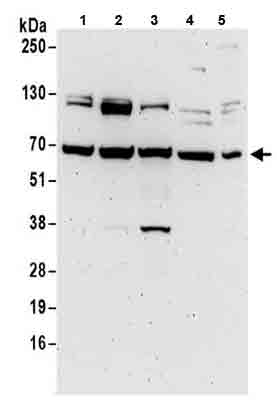 Western blot - Anti-METTL16 antibody (AB186012), expandable thumbnail