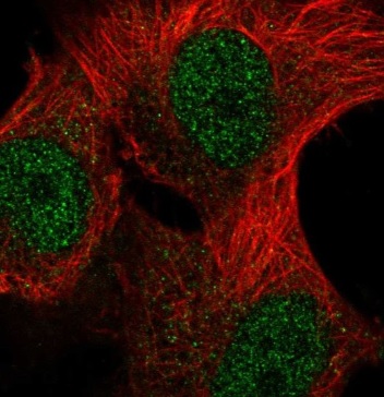 Immunocytochemistry/ Immunofluorescence - Anti-METTL16 antibody (AB221036)