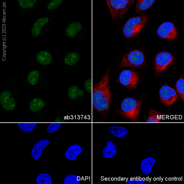 Immunocytochemistry/ Immunofluorescence - Anti-METTL16 antibody [EPR27236-78] (AB313743), expandable thumbnail