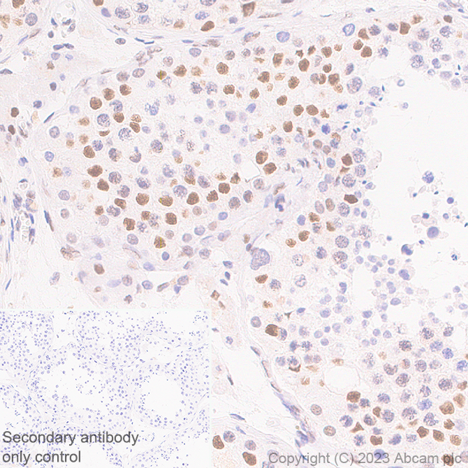 Immunohistochemistry (Formalin/PFA-fixed paraffin-embedded sections) - Anti-METTL16 antibody [EPR27236-78] (ab313743), expandable thumbnail