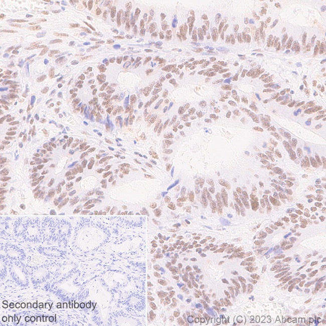 Immunohistochemistry (Formalin/PFA-fixed paraffin-embedded sections) - Anti-METTL16 antibody [EPR27236-78] (ab313743), expandable thumbnail