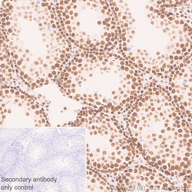 Immunohistochemistry (Formalin/PFA-fixed paraffin-embedded sections) - Anti-METTL16 antibody [EPR27236-78] (ab313743), expandable thumbnail