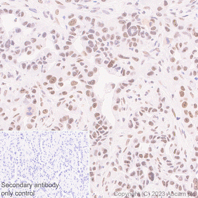 Immunohistochemistry (Formalin/PFA-fixed paraffin-embedded sections) - Anti-METTL16 antibody [EPR27236-78] (ab313743), expandable thumbnail