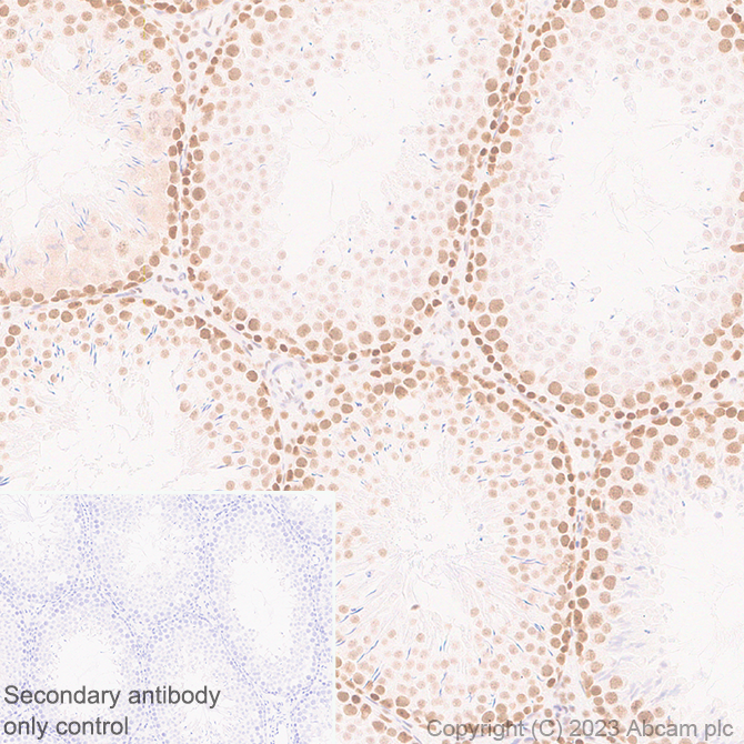 Immunohistochemistry (Formalin/PFA-fixed paraffin-embedded sections) - Anti-METTL16 antibody [EPR27236-78] (AB313743), expandable thumbnail
