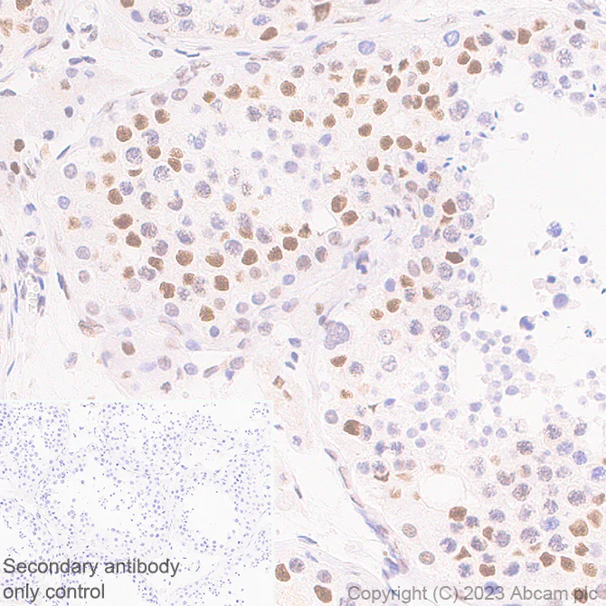 Immunohistochemistry (Formalin/PFA-fixed paraffin-embedded sections) - Anti-METTL16 antibody [EPR27236-78] - BSA and Azide free (AB313744)