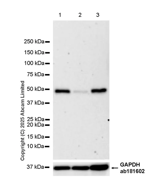 Western blot - Anti-METTL2 antibody [EPR26701-205] (AB324877)