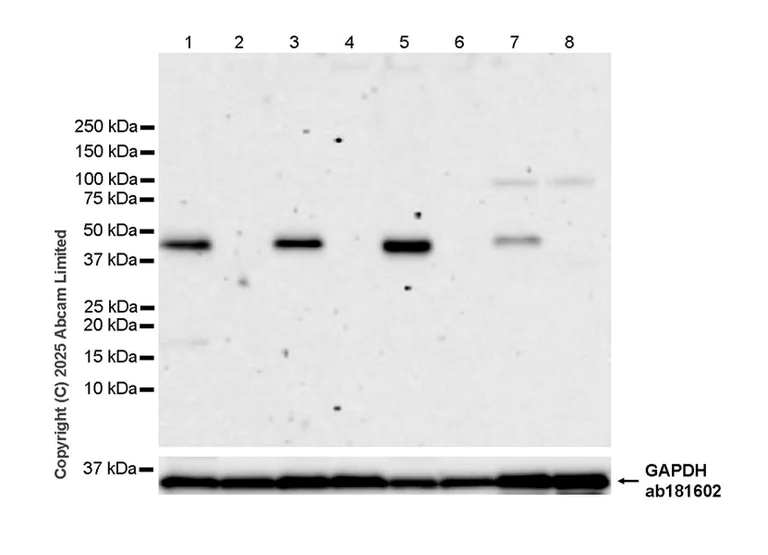 Western blot - Anti-METTL2 antibody [EPR26701-205] (AB324877)