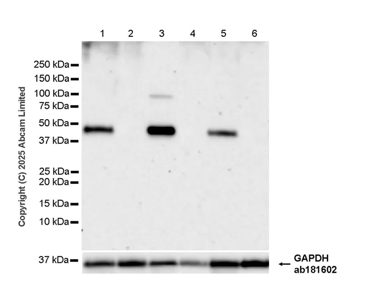 Western blot - Anti-METTL2 antibody [EPR26701-205] (AB324877)