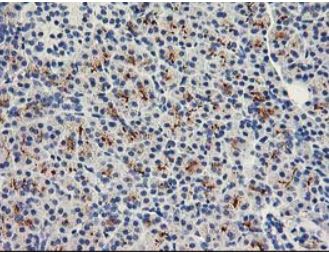 Immunohistochemistry (Formalin/PFA-fixed paraffin-embedded sections) - Anti-METTL21A antibody [OTI2G7] (AB279378)