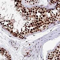 Immunohistochemistry (Formalin/PFA-fixed paraffin-embedded sections) - Anti-METTL21B antibody (AB150900)