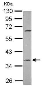 Western blot - Anti-METTL2B antibody (AB101510), expandable thumbnail