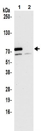 Immunoprecipitation - Anti-METTL3 antibody (AB240595), expandable thumbnail