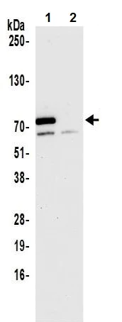 Immunoprecipitation - Anti-METTL3 antibody (AB240595)
