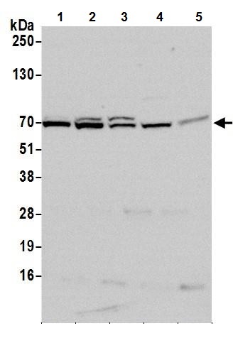 Western blot - Anti-METTL3 antibody (AB240595), expandable thumbnail