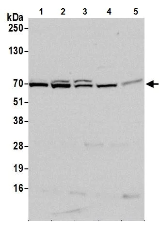 Western blot - Anti-METTL3 antibody (AB240595)