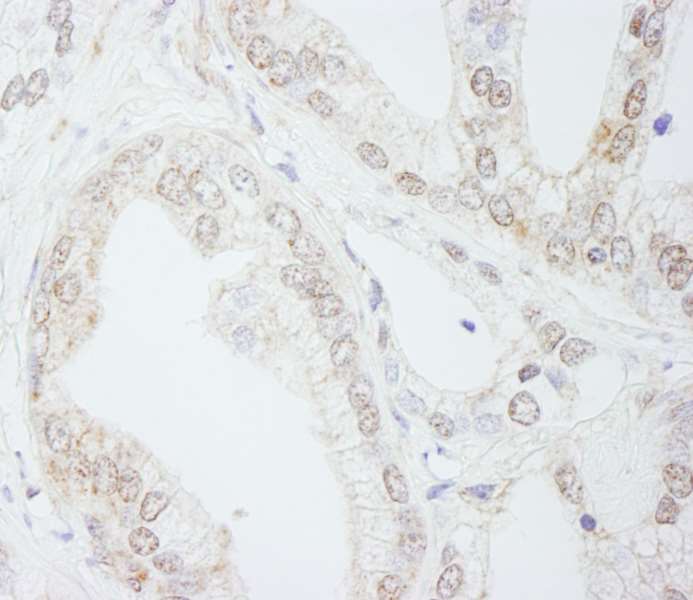 Immunohistochemistry (Formalin/PFA-fixed paraffin-embedded sections) - Anti-METTL3 antibody (AB264211)