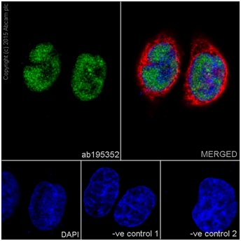 Immunocytochemistry/ Immunofluorescence - Anti-METTL3 antibody [EPR18810] (ab195352), expandable thumbnail